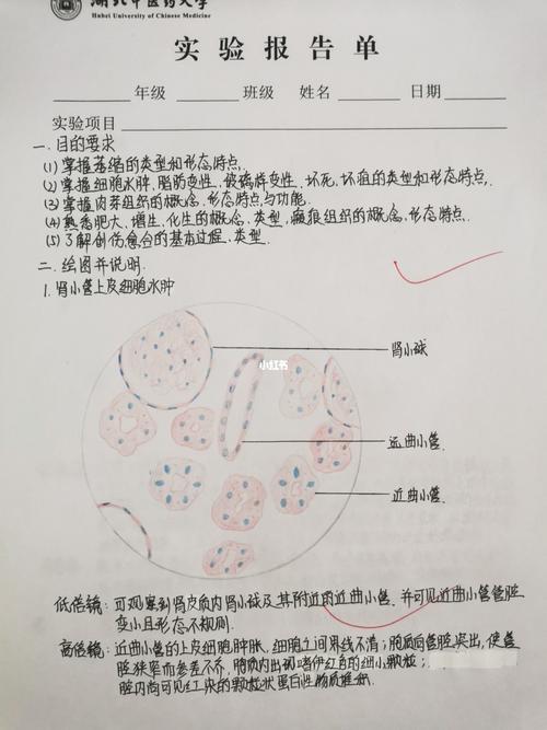 肉芽肿肾水肿红蓝铅笔图