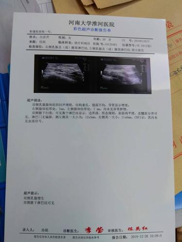 复查结果腹股沟有淋巴结,有事吗?