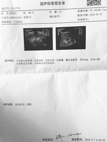 各位宝妈们,昨天去检查报告出来了,怀孕45天,这报告怎么样,谢谢各位