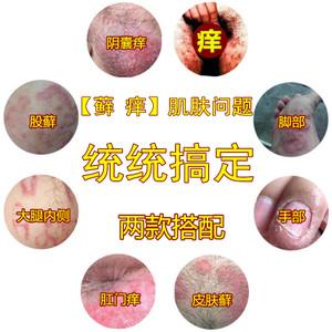 男女大腿内侧痒体股手脚皮肤痒藓廯特效阴囊肛门屁股痒止痒膏成人