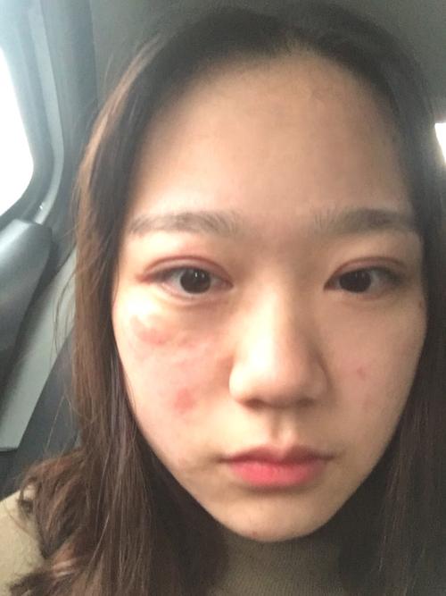 卸妆什么牌子好,护肤,过敏,化妆品