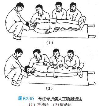遇到脊髓损伤的患者这样搬运,避免造成二次损伤