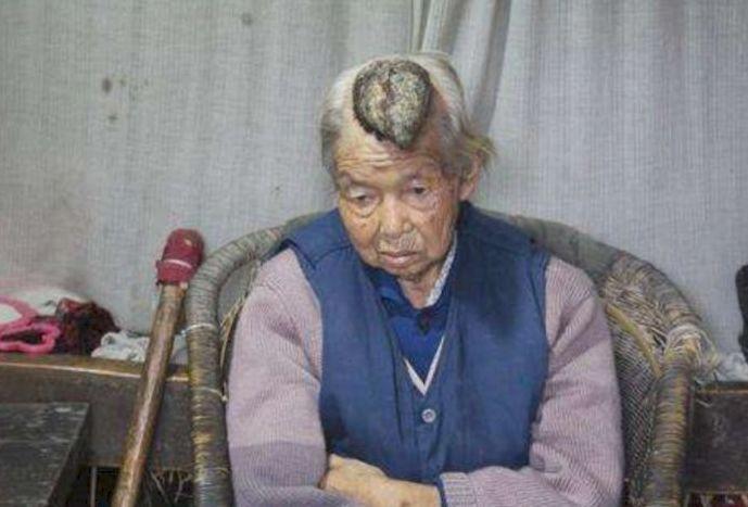 老人百岁额头长角,面对儿女劝阻,她说出了秘密