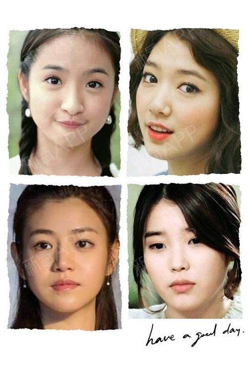 都会担心一个单纯高挺的鼻子,是不是会和自己的整张脸和谐共存  1圆脸