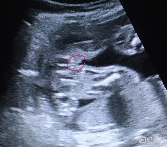 四维突然发现了这个,这是不是女宝的标志