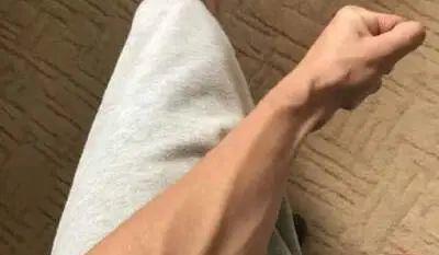 "青筋"暴起,说明有毒素淤积?尤其这几个地方,一定要注意!