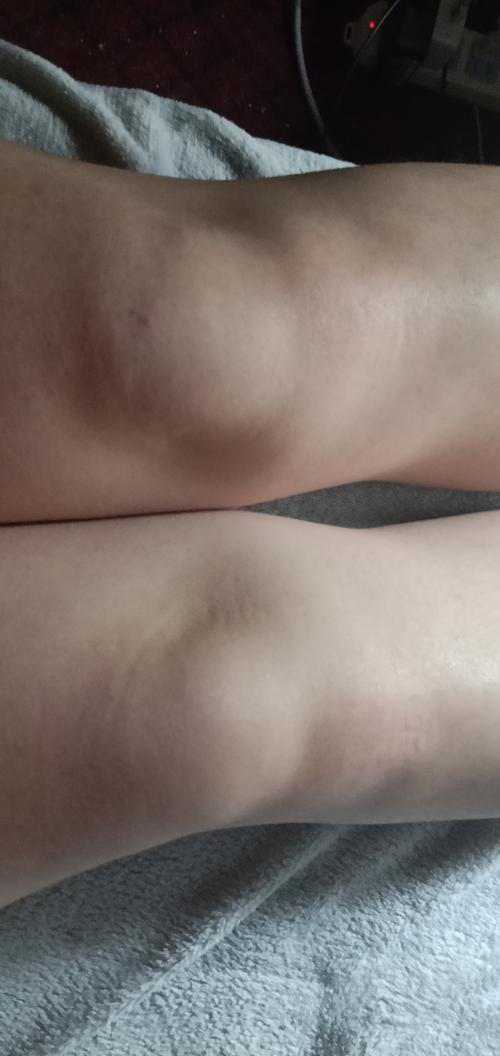 想问问各位姐妹膝盖很突出吗(原谅我黝黑的膝盖)