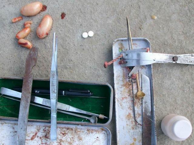 古代太监阉割,都有哪些流程呢?手起刀落,开始崭新的生活