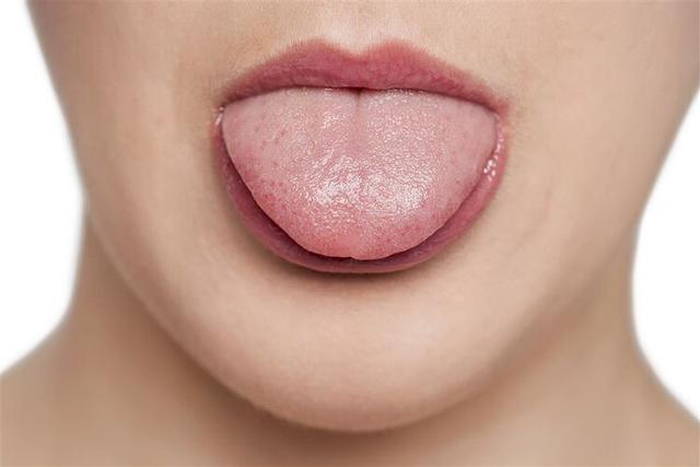 舌为心之苗心脏不好的人舌头会有哪些表现呢