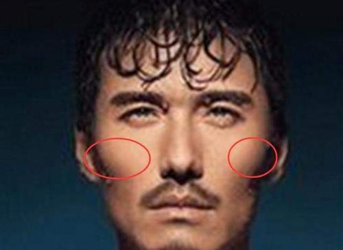 1,两颧骨凸露主克三妻.