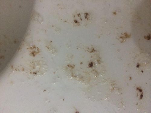 胃病老犯,几个月了,久不久就犯几天.胃疼,胃酸,胃涨,恶心呕吐.