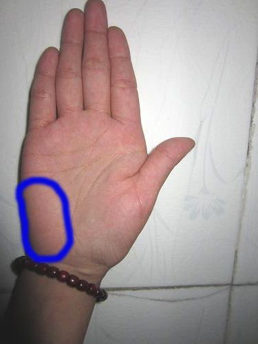 老人家手掌那里老是很红,是什么回事呢?