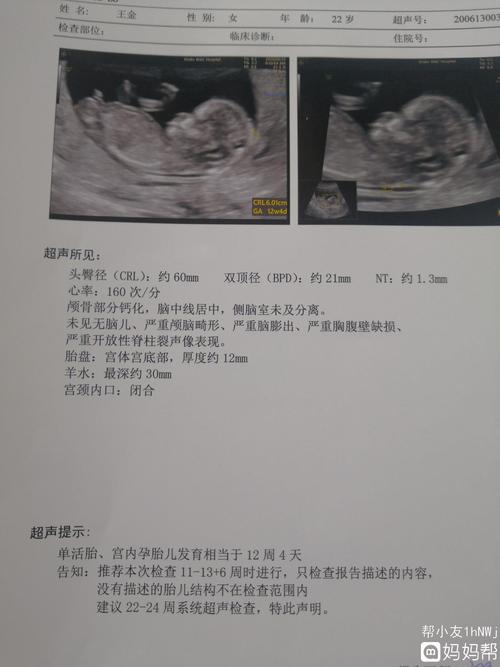 感觉是男孩还是女孩呢 我的nt