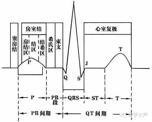 20s(五个小格,一个正方形的格),但是每个p波后面还是有qrs波群.