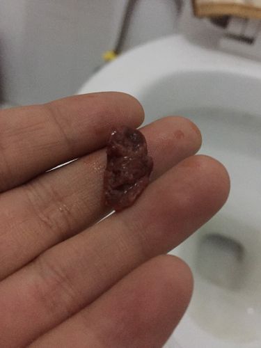 月经期间掉一块肉