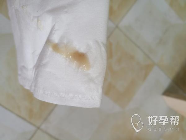 (现在怀孕15周) 白带发黄是偶尔有,有时颜色比这还重