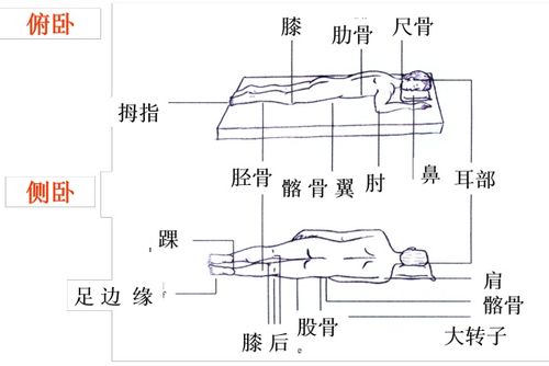 压疮分期与评估大全
