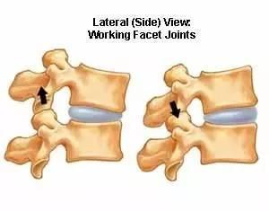 科普腰椎小关节紊乱