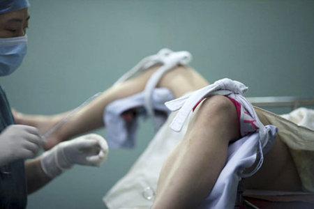 女人:你知道人工流产伤你多深吗?