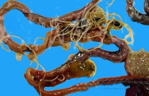 肠道蛔虫病症状图片