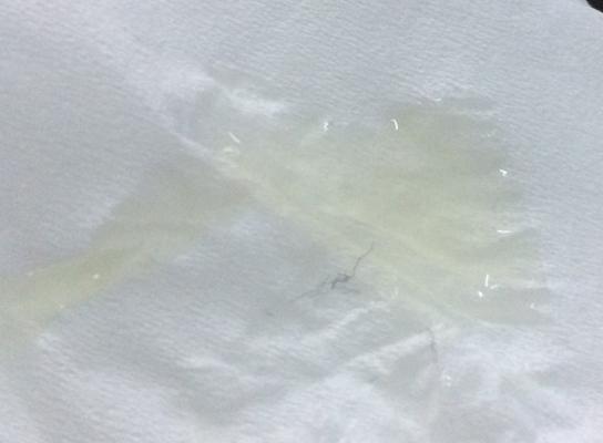 我的精液有点点黄,这样正常吗?