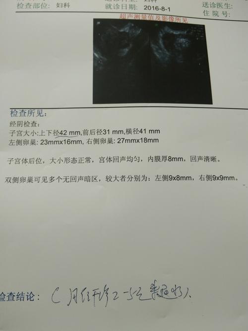 去做了阴超,检查卵泡好不好,医生说我子宫小,请问影响怀孕吗