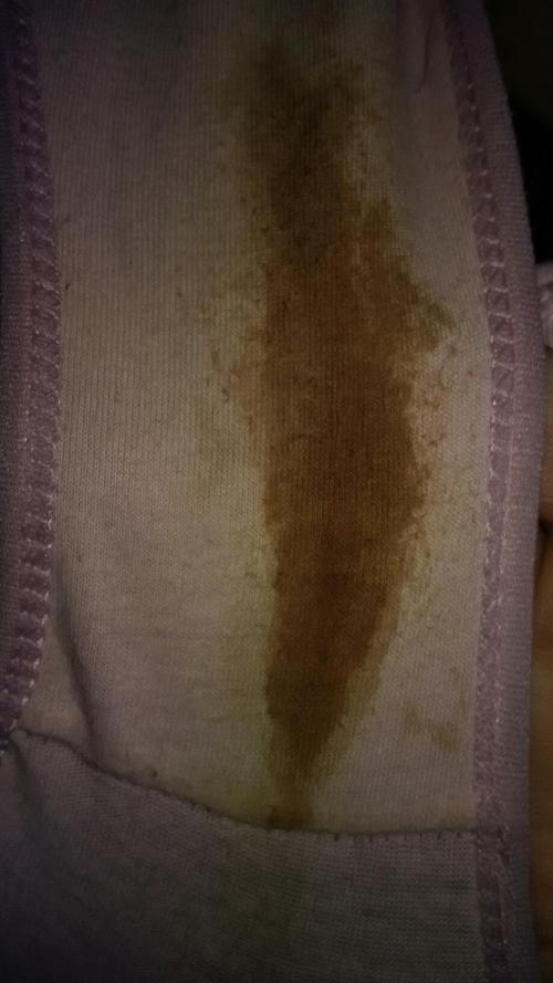 连着三天 都是晚上内裤上搭的褐色分泌物 怎么回事?