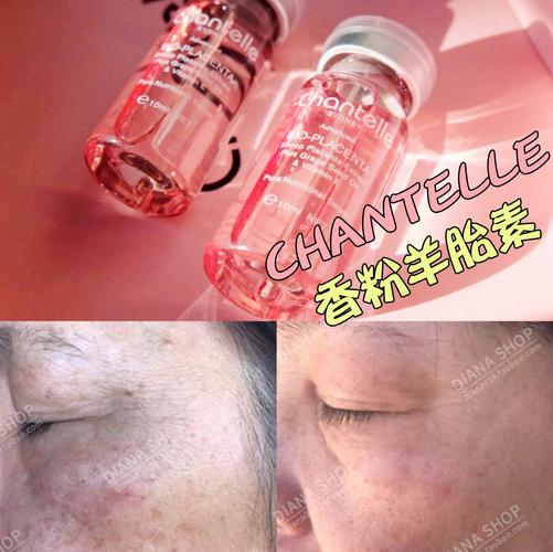 展示与对比:肌肤ni生长!澳洲chantelle香娜露儿羊胎素