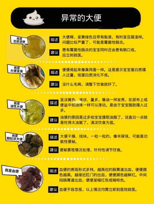 宝宝便便颜色区分_宝宝便便_母婴_育儿经验