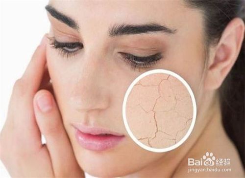 脸部皮肤干燥缺水怎么办?