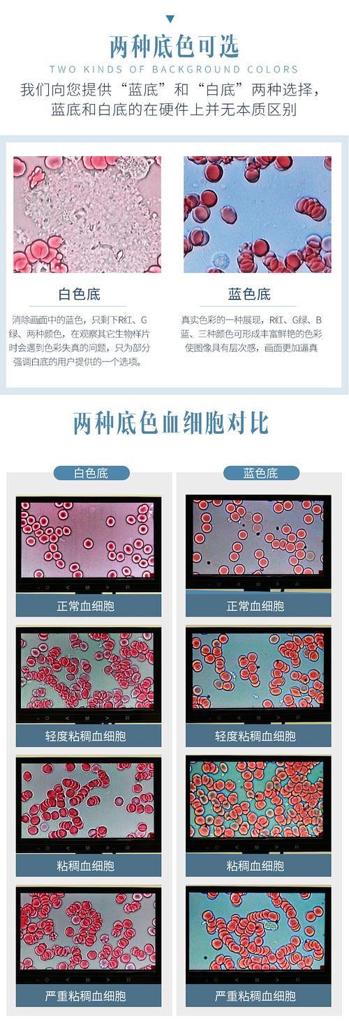 德国一滴血检测仪专业高清生物 显微镜 血液分析螨虫精子排卵细胞