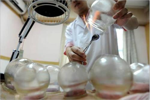 拔罐能排毒吗?答案,简直不可思议