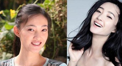 王丽坤整容照片对比照
