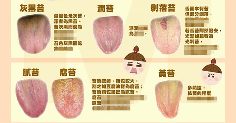 健不健康,看舌苔就知道!从今天开始起床第一件事就是关心你的舌头!