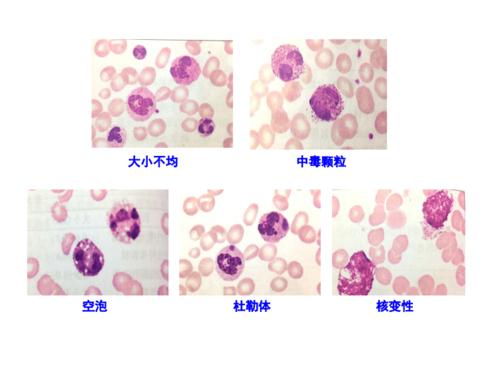 白细胞形态检查(二)上传.pdf 8页