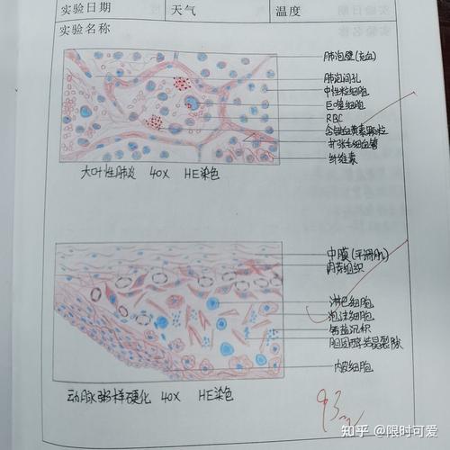病理红蓝铅笔图