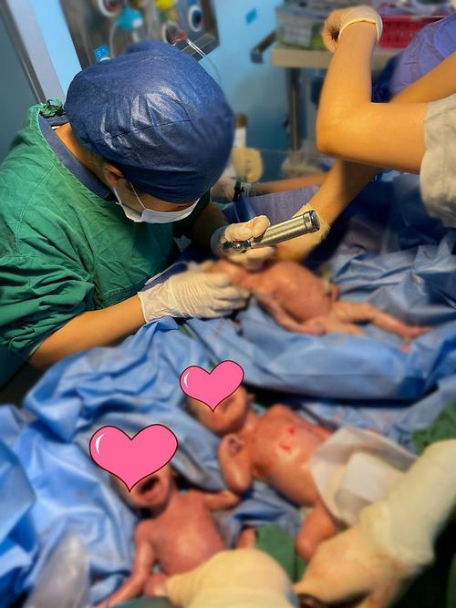 第三个孩子被取出母体,三胞胎在龙岗区人民医院产科手术室顺利降生