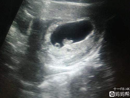 我们家的宝宝7周多