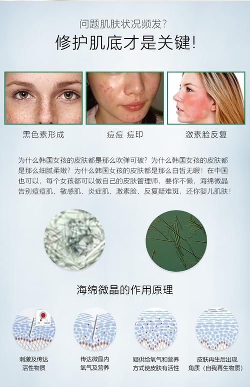 美容院线海藻矽针微晶海绵微针 植物骨针 祛痘淡色印改良暗沉