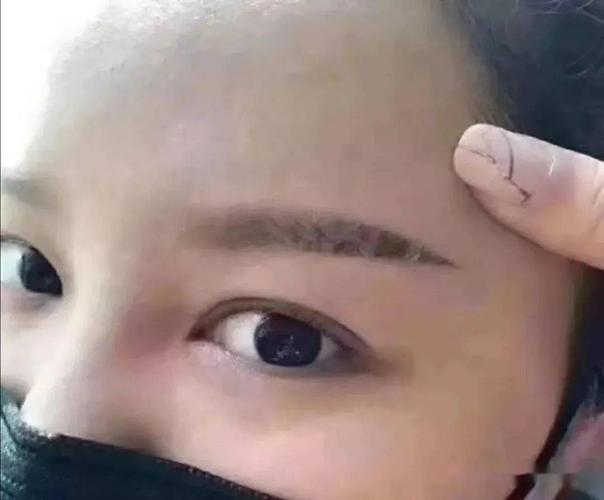 眉毛掉痂没颜色,别慌 看这里?