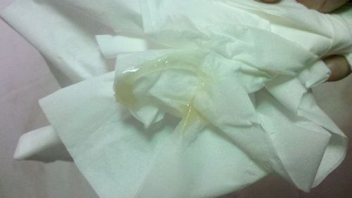 是水样的.然后开大后擦pp.白带就变成果冻状了.很有粘性.咋回事.