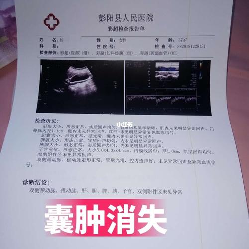 宫颈纳氏囊肿消了_宫颈糜烂_宫颈纳氏囊肿_医疗健康