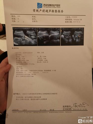 三尖瓣少量反流,帮忙看下