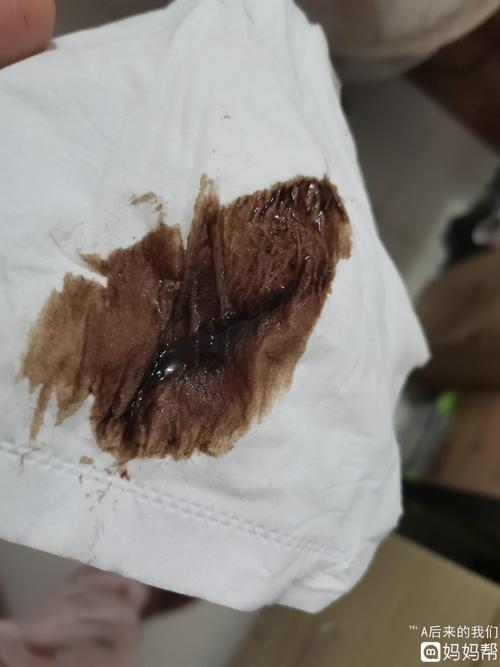 姐妹门帮我看下 刚起来小便 出现褐色分 - 2020年8月预产期帮 - 妈妈