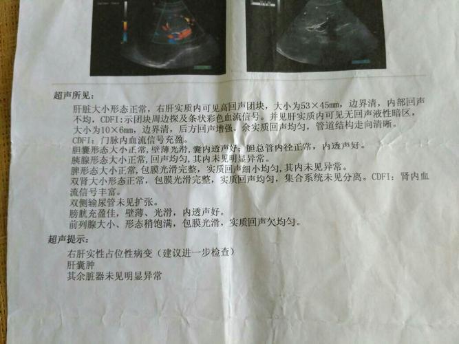 肝血管瘤,今年体检说已到6厘米,我想问一下用什么方法