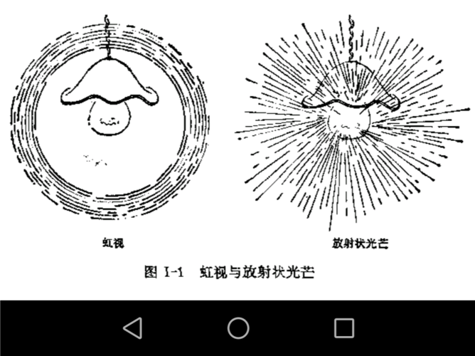 眼科常见症状之虹视