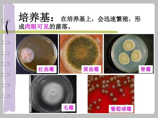 红曲霉 黄曲霉 青霉 毛霉 葡萄球霉