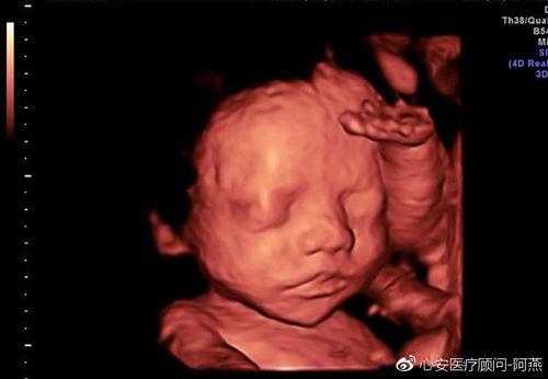 怀孕24周去医院做四维,医生看到宝宝表情后,痛骂孕妈不自爱