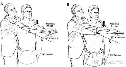 研磨测试 患者仰卧,肩外展90度,手肘屈90度,治疗者一手将肱骨向肩关节