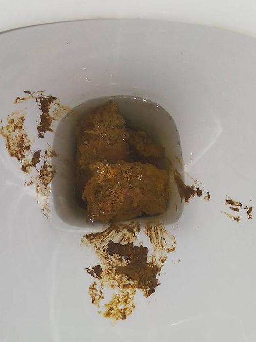 大便这样是正常的吗,如果不是正常是怎么回事?谢谢